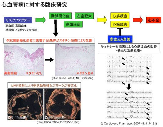 心血管病 イメージ1