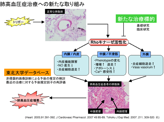 肺高血圧症