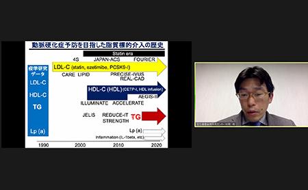 2月17日(水)「第161回 仙台心臓血管研究会」（オンライン）を開催しました。イメージ2