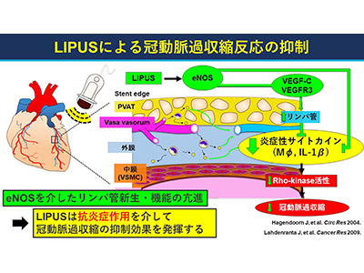 第172回日本循環器学会東北地方会において、当科の渡辺翼（大学院4年生）がYIA基礎部門最優秀賞を受賞しました。イメージ2