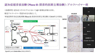 10月11日（月）第2回Brain Stormingを開催しました。 イメージ2