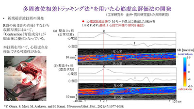 10月11日（月）第2回Brain Stormingを開催しました。 イメージ3