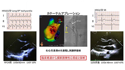 12月13日（月）第４回Brain Stormingを開催しました。 イメージ4