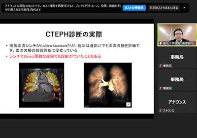 2月24日（木）「2021年度 第9回 東北大学病院循環器生涯教育講座」（オンライン）を開催しました。イメージ2