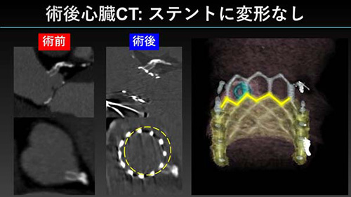 2月24日（木）「2021年度 第9回 東北大学病院循環器生涯教育講座」（オンライン）を開催しました。イメージ1