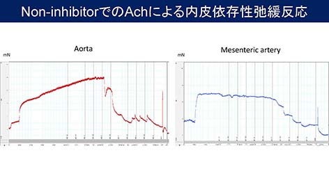 7月25日（月）Work in Progressを開催しました。イメージ4