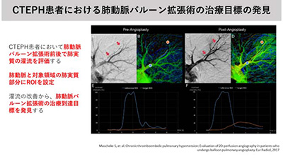 9月12日（月）Brain Stormingを開催しました。イメージ2