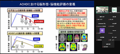 20250127BS1