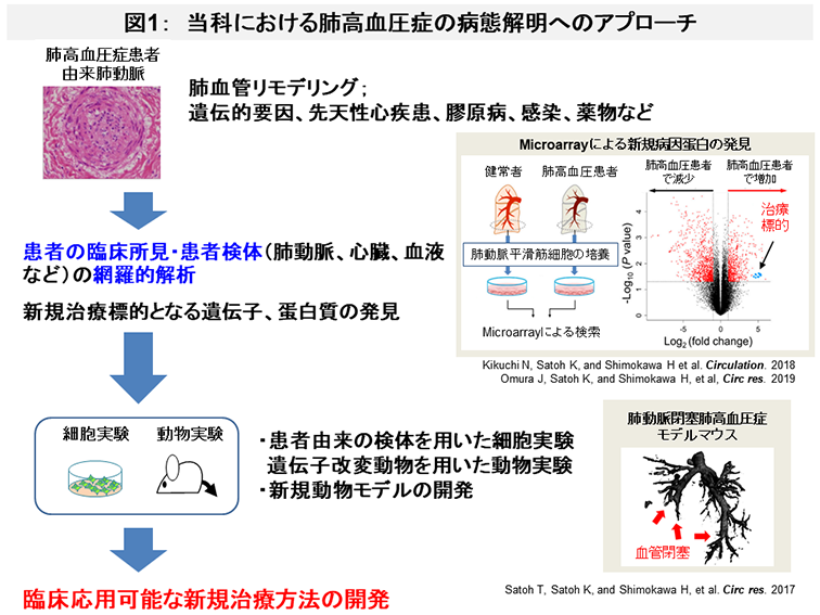 肺高血圧症 東北大学病院 循環器内科