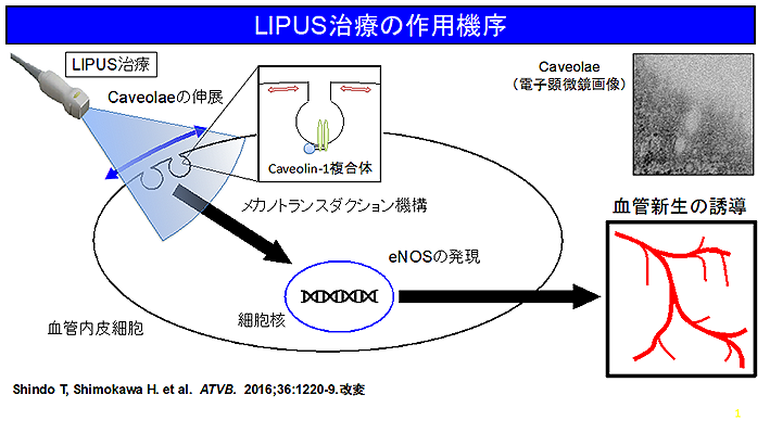 us1